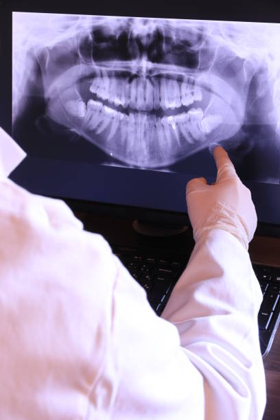 Best Emergency Tooth Extraction in Florham Park, NJ