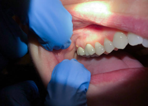 Best Pediatric Emergency Dentist in Florham Park, NJ