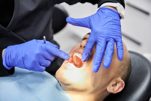 Best Emergency Treatment for Toothache in Florham Park, NJ